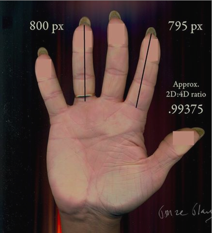 ./2015-07-05 - AnneRose Blayk - Digit Ratio from Handscan - Screen Shot 2015-07-05 at 7.35.43 AM.png